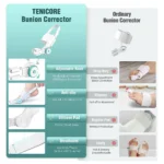 Orthèse hallux valgus de nuit